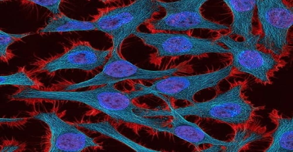 Life Threatening Cancer and It’s Biomarker