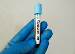 coagulation testing market