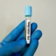 coagulation testing market