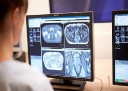 molecular imaging market